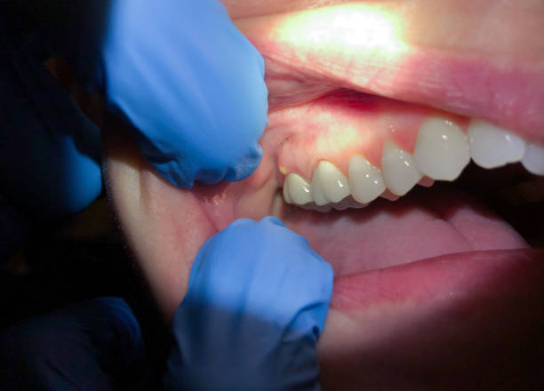Best Pediatric Emergency Dentist in Polkton, NC