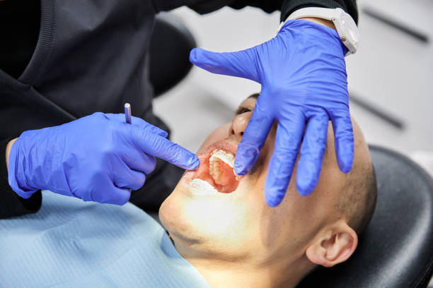 Best Emergency Dental Care for Broken or Chipped Teeth in Polkton, NC